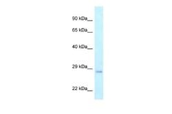 CRIF1 Antibody, Novus Biologicals 100 &mu;L | Buy Online | Novus Biologicals | Fisher Scientific